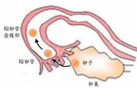 怎样预防卵巢性不孕