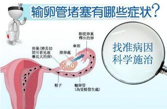 输卵管堵塞症状