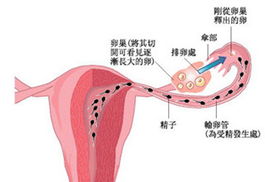 输卵管粘连